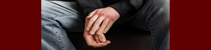 El acoso escolar deja huellas visibles e invisibles